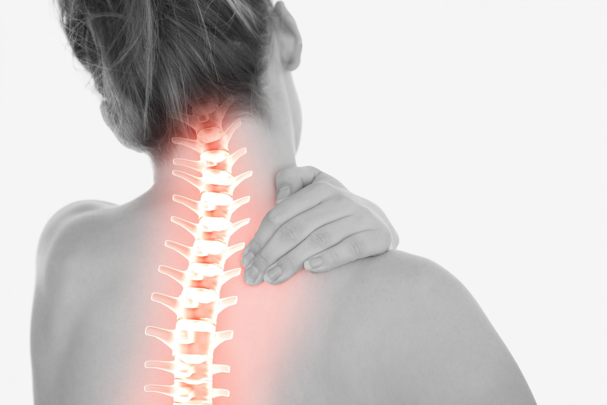 H Rnia Discal Cervical Do Diagn Stico Ao Tratamento Unidade De Sa De Hospital Da Trofa