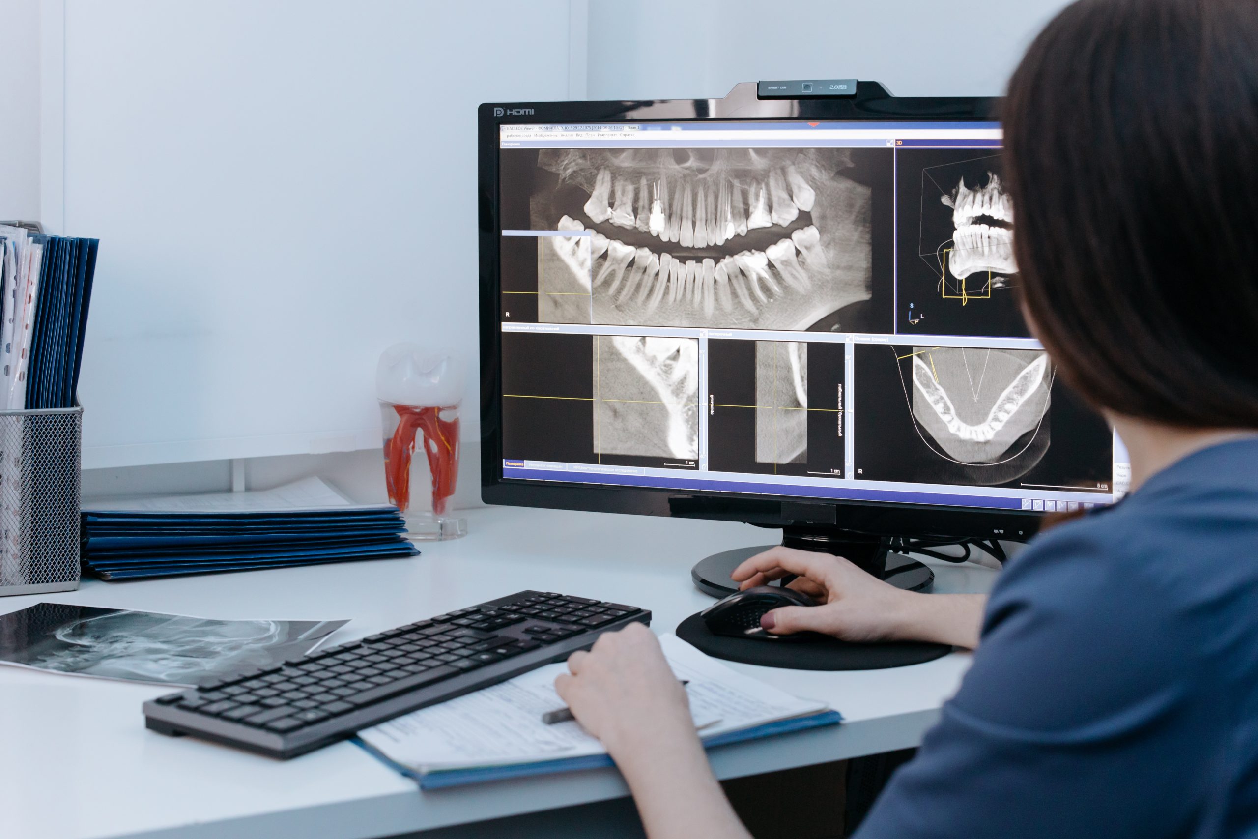 Cirurgia de implantes